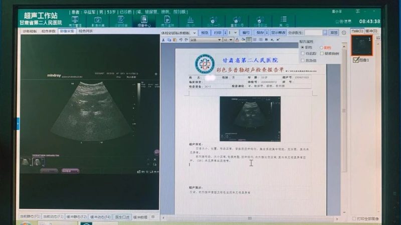 婚前检查，女性必看的项目清单**